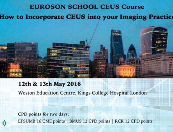 CEUS London